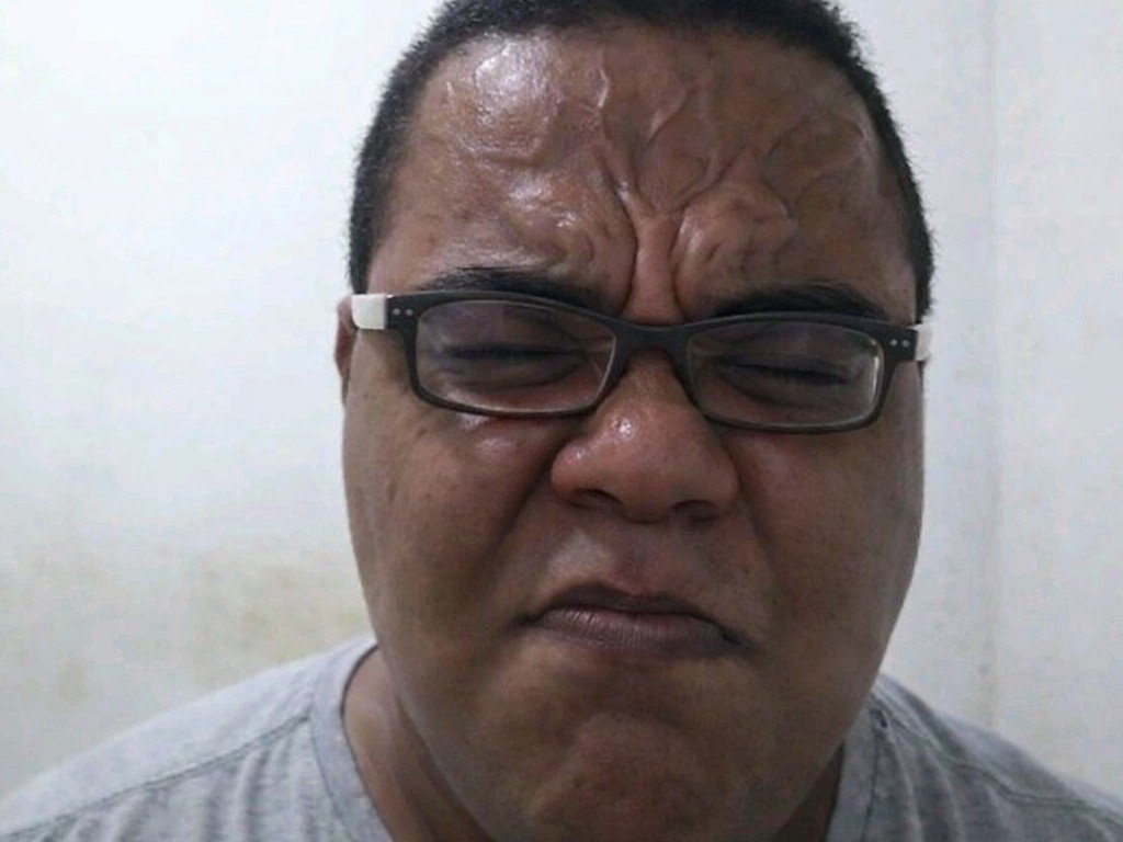 giuseppe pousse monstre umd asile bois colombes danse puant caca veine front bgnldmrd