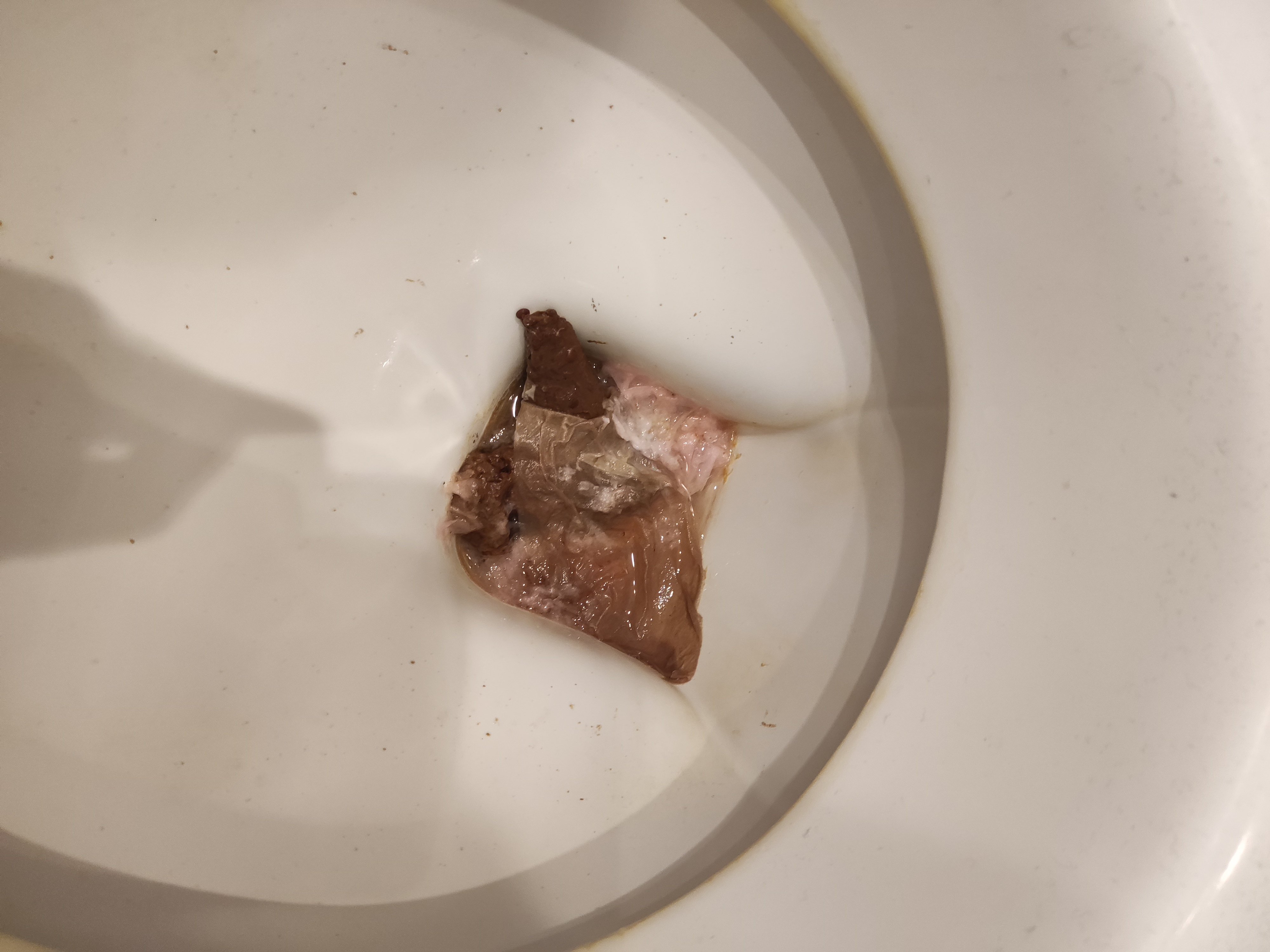 toilettes wc excrements