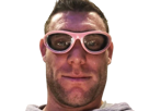 james-milner-tete-de-ouf-2-lunettes