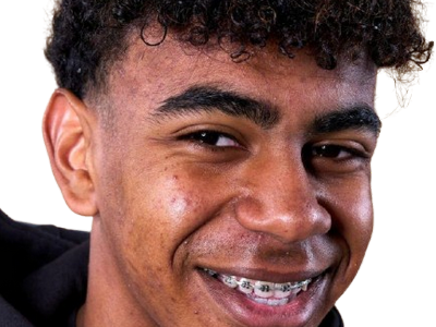 lamine yamal moche ugly affreux laid puant horrible degoutant repoussant puceau pucix odeur abominable marocain