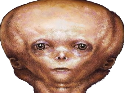 foetus symetrie miroir alien chauve