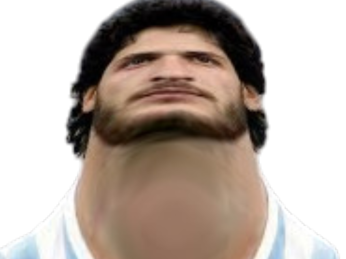 khvicha kvaratskhelia kvaradona kvaradonna argentine tete gonfle deformee deforme