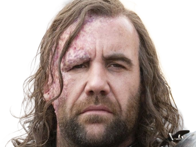 sandor clegane limier chien cicatrice brule game thrones agot serie rory mccann homme yeux-marrons cheveux-bruns