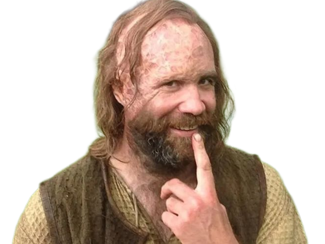 sandor clegane limier chien cicatrice brule game thrones agot serie rory mccann homme yeux-marrons cheveux-bruns