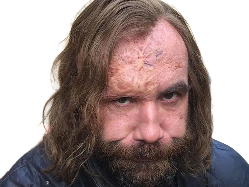 sandor clegane limier chien cicatrice brule game thrones agot serie rory mccann homme yeux-marrons cheveux-bruns
