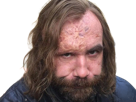 sandor-clegane-limier-chien-cicatrice-brule-game-thrones-agot-serie-rory-mccann-homme-yeux-marrons-cheveux-bruns