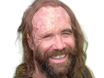 sandor clegane limier chien cicatrice brule game thrones agot serie rory mccann homme yeux-marrons cheveux-bruns