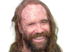 sandor-clegane-limier-chien-cicatrice-brule-game-thrones-agot-serie-rory-mccann-homme-yeux-marrons-cheveux-bruns