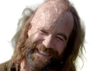 sandor-clegane-limier-chien-cicatrice-brule-game-thrones-agot-serie-rory-mccann-homme-yeux-marrons-cheveux-bruns
