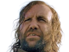 sandor-clegane-limier-chien-cicatrice-brule-game-thrones-agot-serie-rory-mccann-homme-yeux-marrons-cheveux-bruns