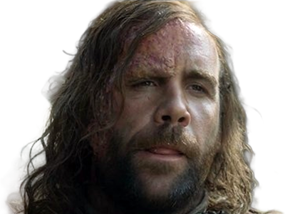 sandor clegane limier chien cicatrice brule game thrones agot serie rory mccann homme yeux-marrons cheveux-bruns