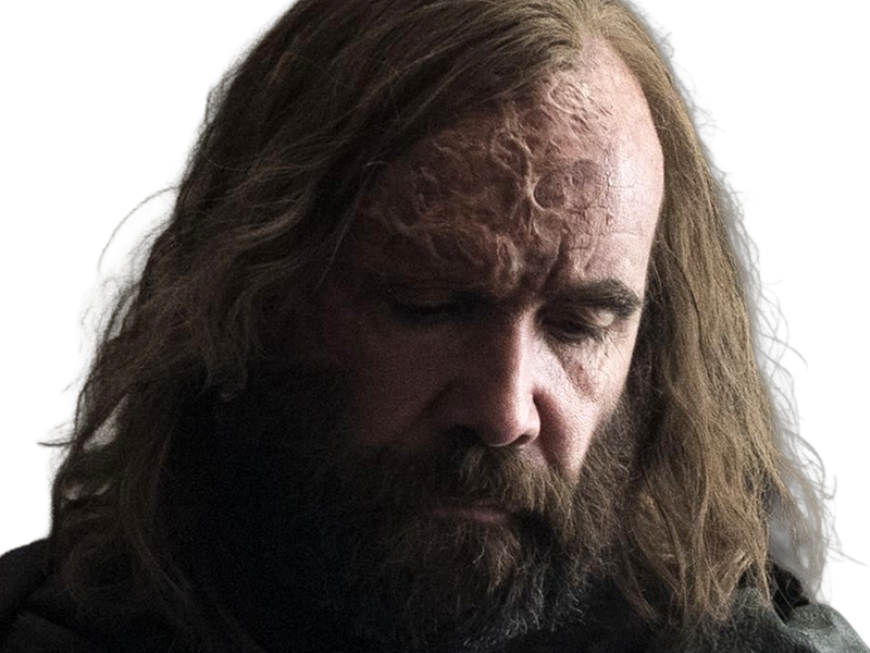 sandor clegane limier chien cicatrice brule game thrones agot serie rory mccann homme yeux-marrons cheveux-bruns