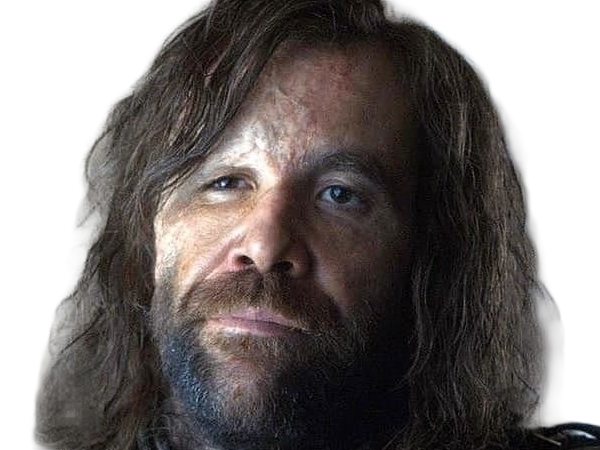 sandor clegane limier chien cicatrice brule game thrones agot serie rory mccann homme yeux-marrons cheveux-bruns