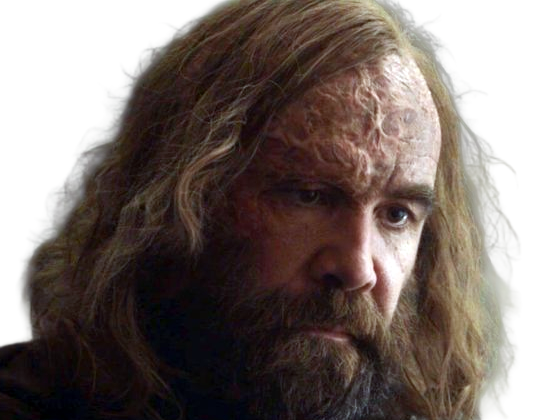 sandor clegane limier chien cicatrice brule game thrones agot serie rory mccann homme yeux-marrons cheveux-bruns