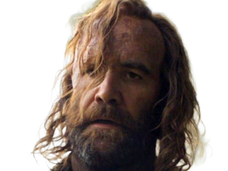 sandor clegane limier chien cicatrice brule game thrones agot serie rory mccann homme yeux-marrons cheveux-bruns