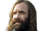 sandor-clegane-limier-chien-cicatrice-brule-game-thrones-agot-serie-rory-mccann-homme-yeux-marrons-cheveux-bruns