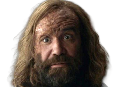sandor clegane limier chien cicatrice brule game thrones agot serie rory mccann homme yeux-marrons cheveux-bruns