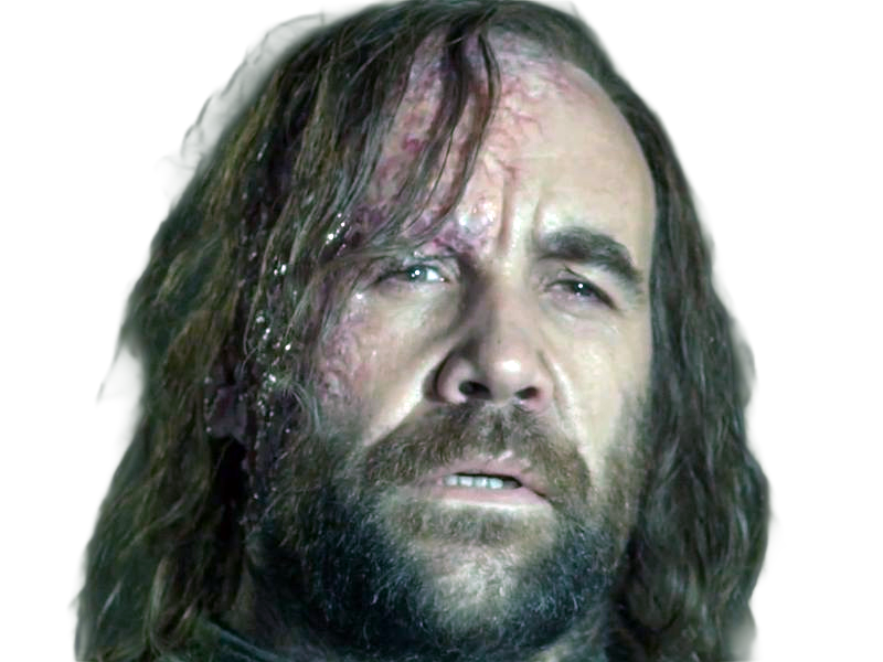 sandor clegane limier chien cicatrice brule game thrones agot serie rory mccann homme yeux-marrons cheveux-bruns