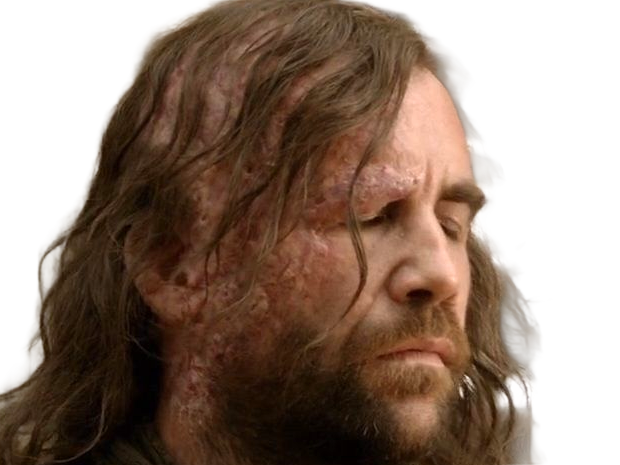 sandor clegane limier chien cicatrice brule game thrones agot serie rory mccann homme yeux-marrons cheveux-bruns