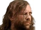 sandor-clegane-limier-chien-cicatrice-brule-game-thrones-agot-serie-rory-mccann-homme-yeux-marrons-cheveux-bruns