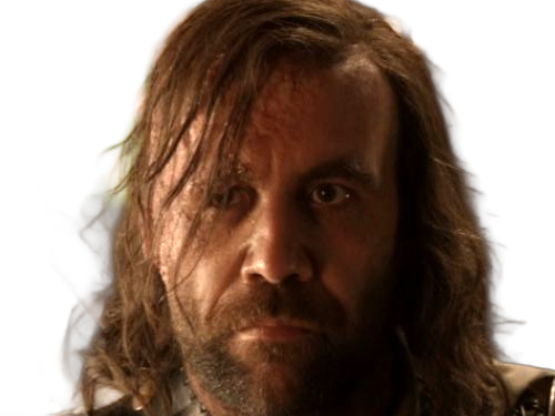 sandor clegane limier chien cicatrice brule game thrones agot serie rory mccann homme yeux-marrons cheveux-bruns