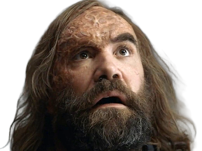 sandor clegane limier chien cicatrice brule game thrones agot serie rory mccann homme yeux-marrons cheveux-bruns