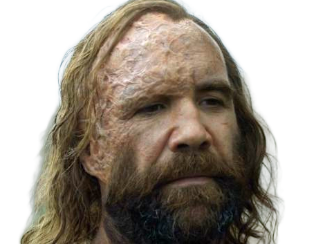 sandor clegane limier chien cicatrice brule game thrones agot serie rory mccann homme yeux-marrons cheveux-bruns