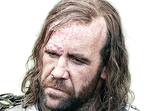 sandor clegane limier chien cicatrice brule game thrones agot serie rory mccann homme yeux-marrons cheveux-bruns