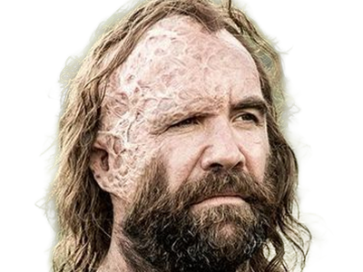 sandor clegane limier chien cicatrice brule game thrones agot serie rory mccann homme yeux-marrons cheveux-bruns