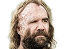 sandor-clegane-limier-chien-cicatrice-brule-game-thrones-agot-serie-rory-mccann-homme-yeux-marrons-cheveux-bruns