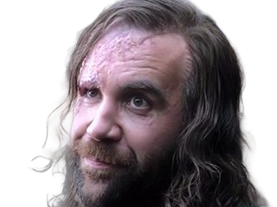 sandor clegane limier chien cicatrice brule game thrones agot serie rory mccann homme yeux-marrons cheveux-bruns