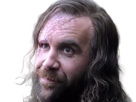 sandor-clegane-limier-chien-cicatrice-brule-game-thrones-agot-serie-rory-mccann-homme-yeux-marrons-cheveux-bruns