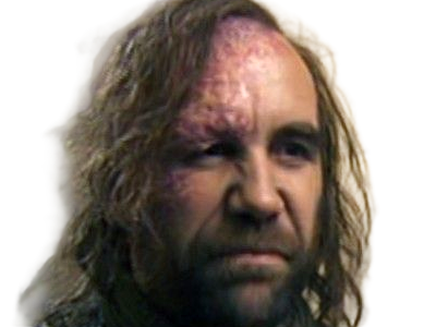 sandor clegane limier chien cicatrice brule game thrones agot serie rory mccann homme yeux-marrons cheveux-bruns