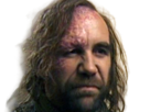 sandor-clegane-limier-chien-cicatrice-brule-game-thrones-agot-serie-rory-mccann-homme-yeux-marrons-cheveux-bruns