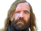 sandor-clegane-limier-chien-cicatrice-brule-game-thrones-agot-serie-rory-mccann-homme-yeux-marrons-cheveux-bruns