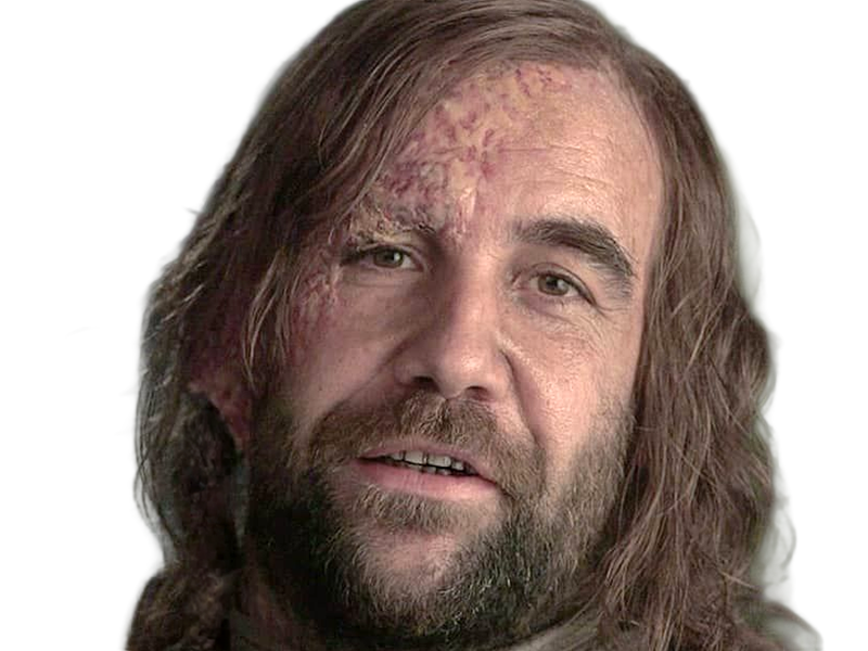 sandor clegane limier chien cicatrice brule game thrones agot serie rory mccann homme yeux-marrons cheveux-bruns