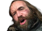sandor-clegane-limier-chien-cicatrice-brule-game-thrones-agot-serie-rory-mccann-homme-yeux-marrons-cheveux-bruns