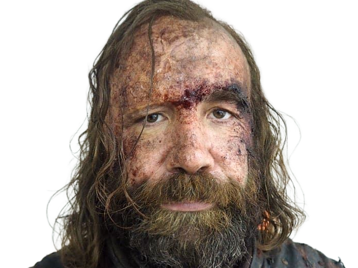 sandor clegane limier chien cicatrice brule game thrones agot serie rory mccann homme yeux-marrons cheveux-bruns