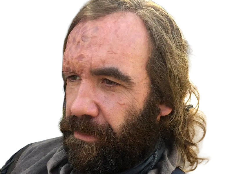 sandor clegane limier chien cicatrice brule game thrones agot serie rory mccann homme yeux-marrons cheveux-bruns