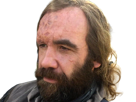 sandor-clegane-limier-chien-cicatrice-brule-game-thrones-agot-serie-rory-mccann-homme-yeux-marrons-cheveux-bruns