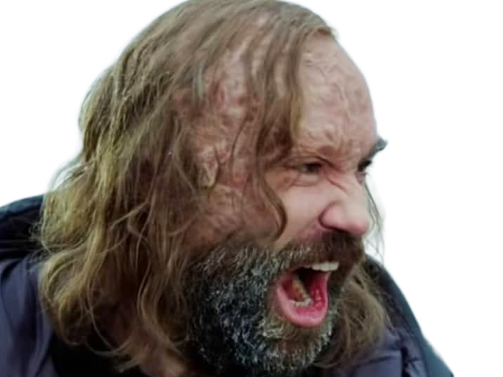 sandor clegane limier chien cicatrice brule game thrones agot serie rory mccann homme yeux-marrons cheveux-bruns