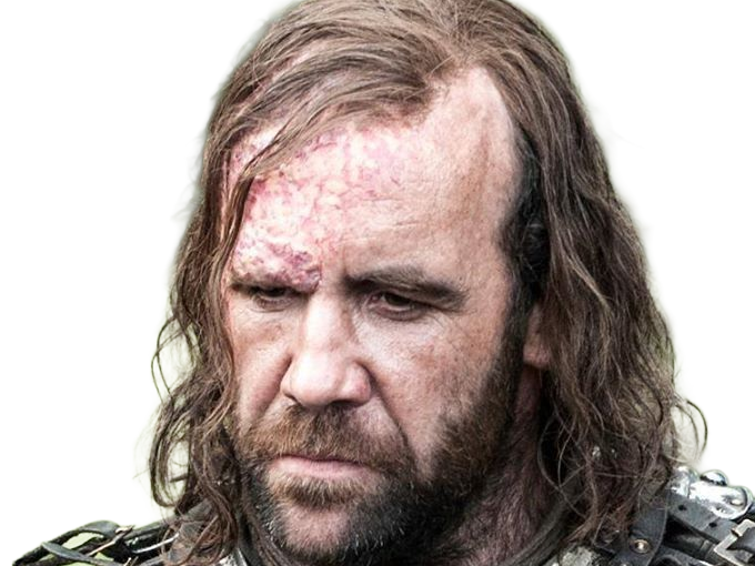 sandor clegane limier chien cicatrice brule game thrones agot serie rory mccann homme yeux-marrons cheveux-bruns