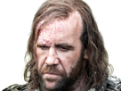 sandor-clegane-limier-chien-cicatrice-brule-game-thrones-agot-serie-rory-mccann-homme-yeux-marrons-cheveux-bruns