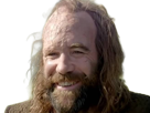 sandor-clegane-limier-chien-cicatrice-brule-game-thrones-agot-serie-rory-mccann-homme-yeux-marrons-cheveux-bruns
