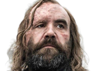 sandor-clegane-limier-chien-cicatrice-brule-game-thrones-agot-serie-rory-mccann-homme-yeux-marrons-cheveux-bruns