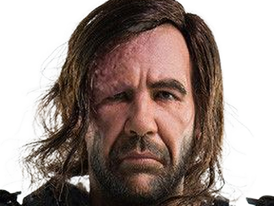 sandor clegane limier chien cicatrice brule game thrones agot serie rory mccann homme yeux-marrons cheveux-bruns
