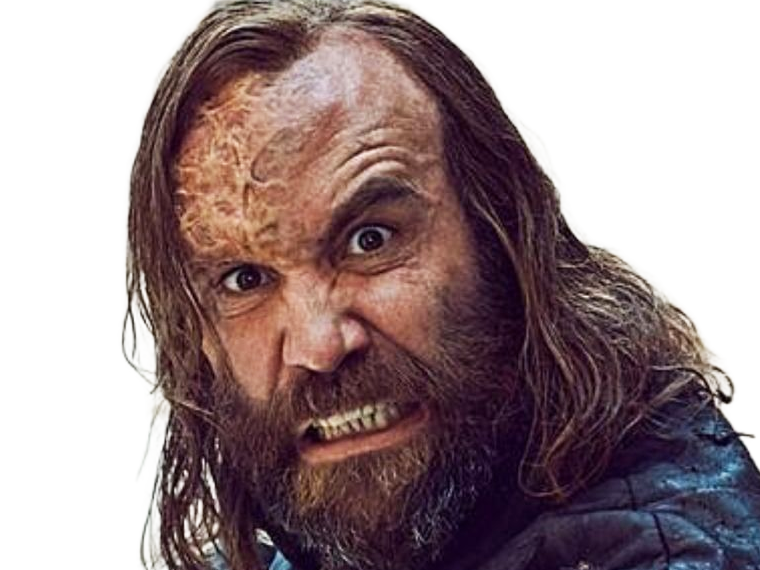 sandor clegane limier chien cicatrice brule game thrones agot serie rory mccann homme yeux-marrons cheveux-bruns