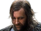 sandor-clegane-limier-chien-cicatrice-brule-game-thrones-agot-serie-rory-mccann-homme-yeux-marrons-cheveux-bruns