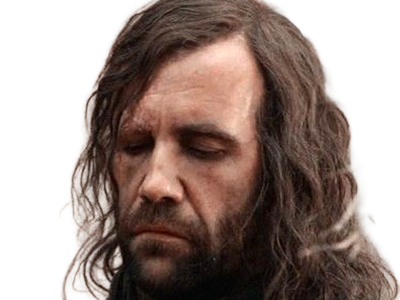 sandor clegane limier chien cicatrice brule game thrones agot serie rory mccann homme yeux-marrons cheveux-bruns