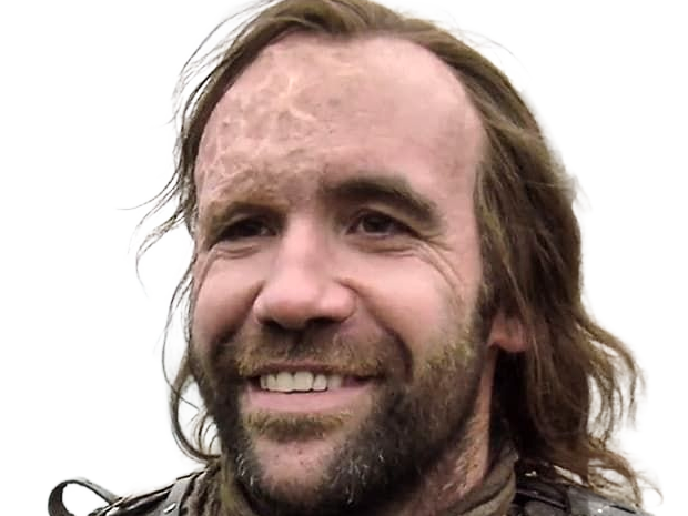 sandor clegane limier chien cicatrice brule game thrones agot serie rory mccann homme yeux-marrons cheveux-bruns